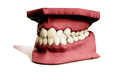image2-teeth-page2